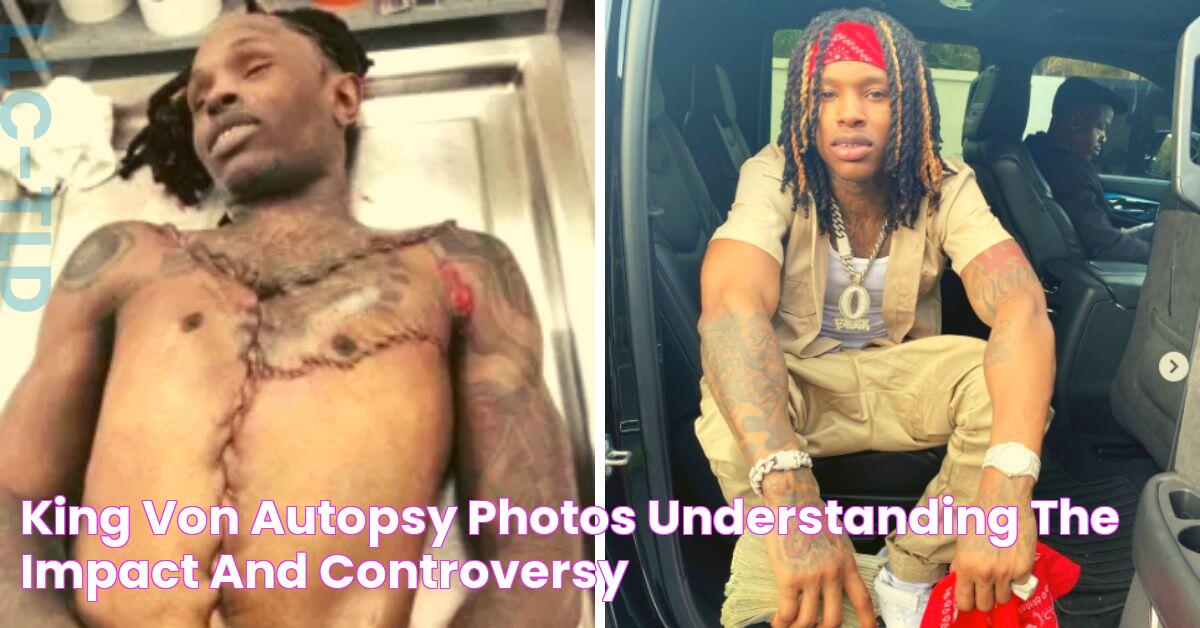 Unveiling The Truth: Autopsy Report Of Rapper King Von