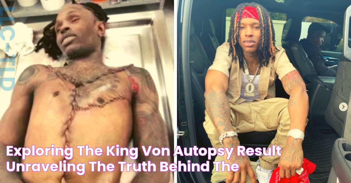 Exploring The King Von Autopsy Result Unraveling The Truth Behind The