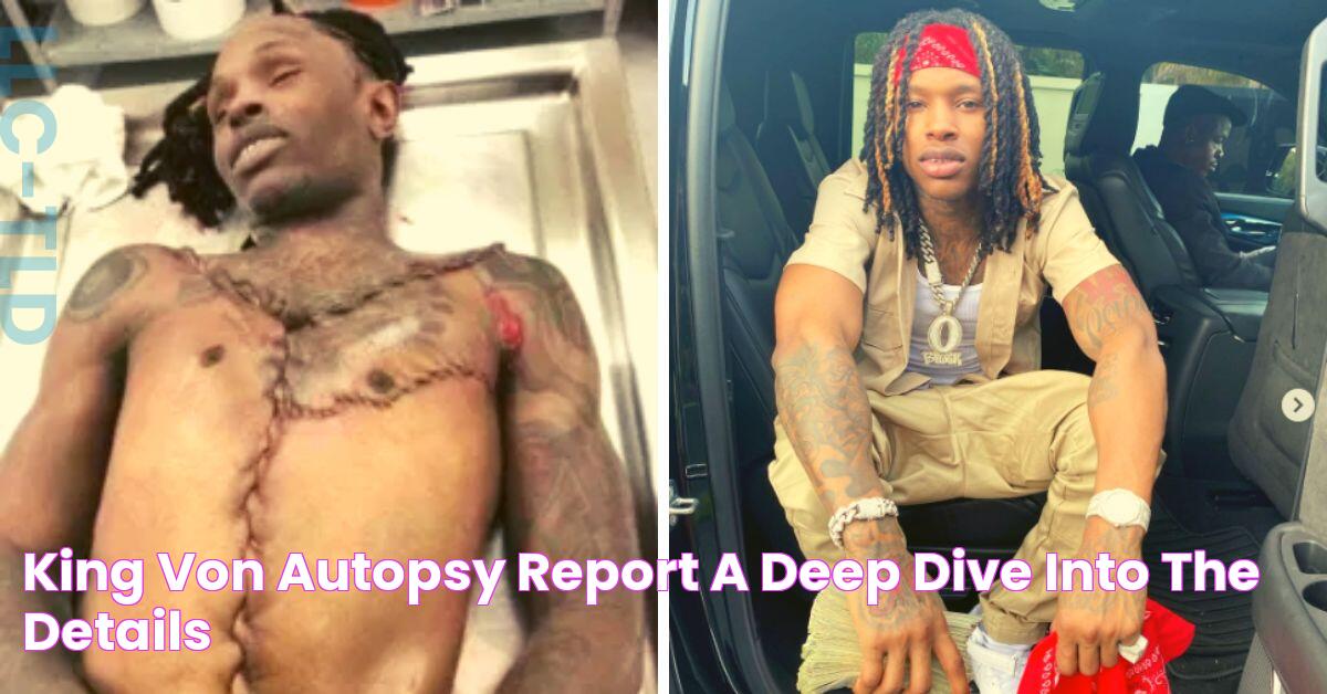 King Von Autopsy Report A Deep Dive Into The Details