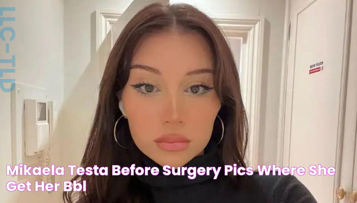 Mikaela Testa Before Surgery Pics, Where She Get Her BBL?