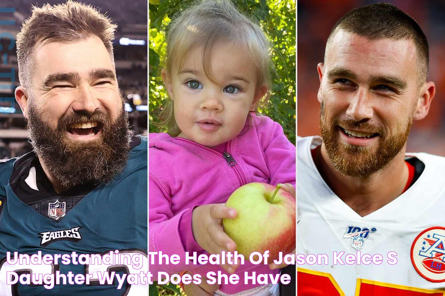 Does Wyatt Kelce Have Down Syndrome? Uncovering The Truth