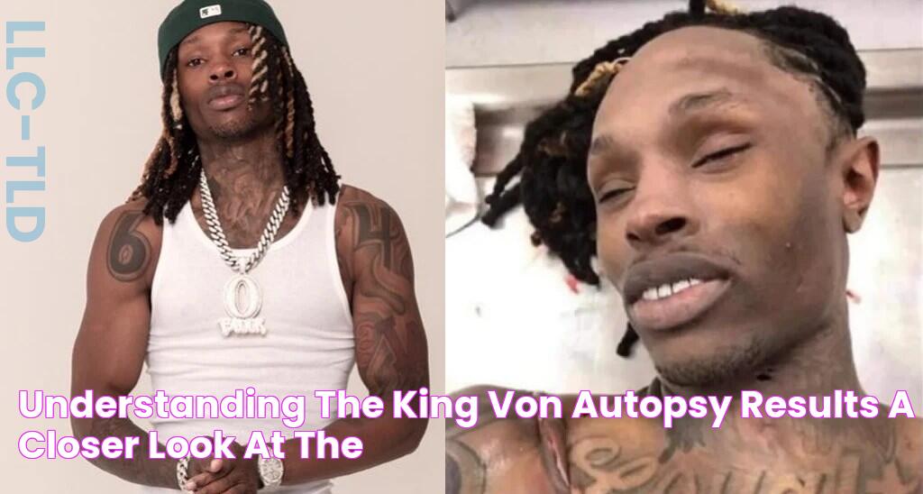 Understanding the King Von Autopsy Results A Closer Look at the