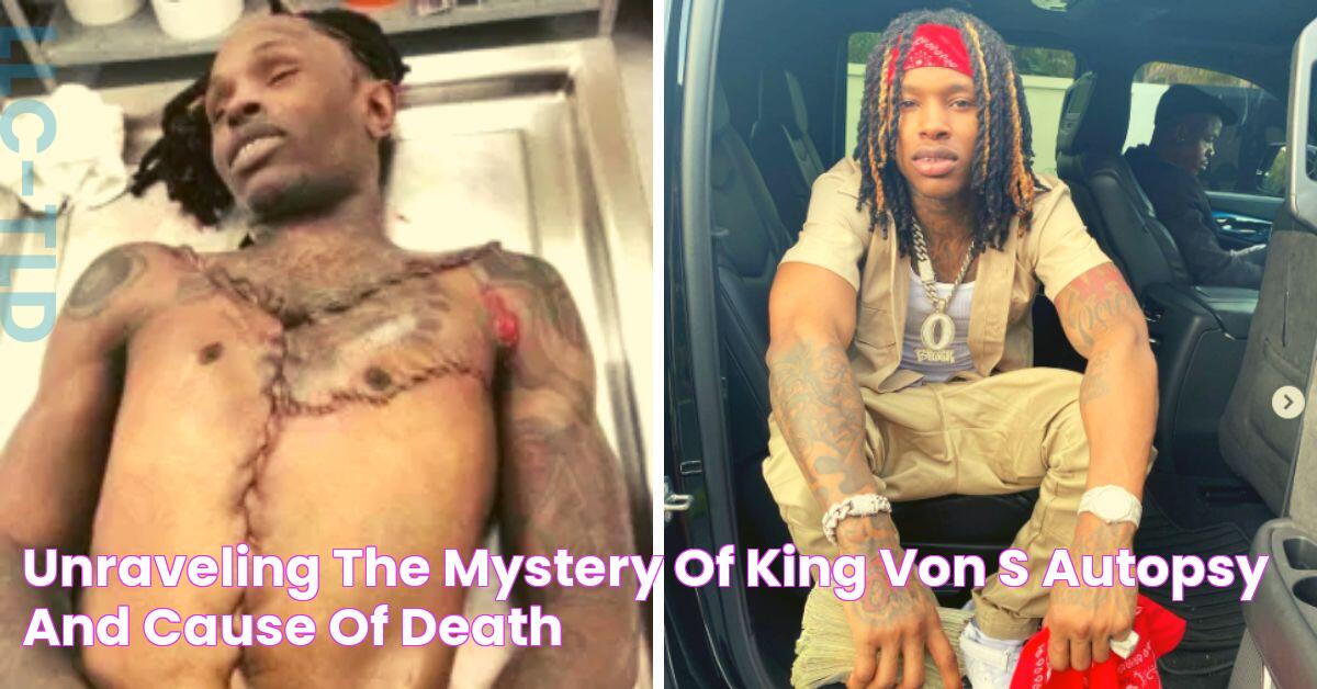 Definitive Guide: Uncovering King Von's Autopsy Report