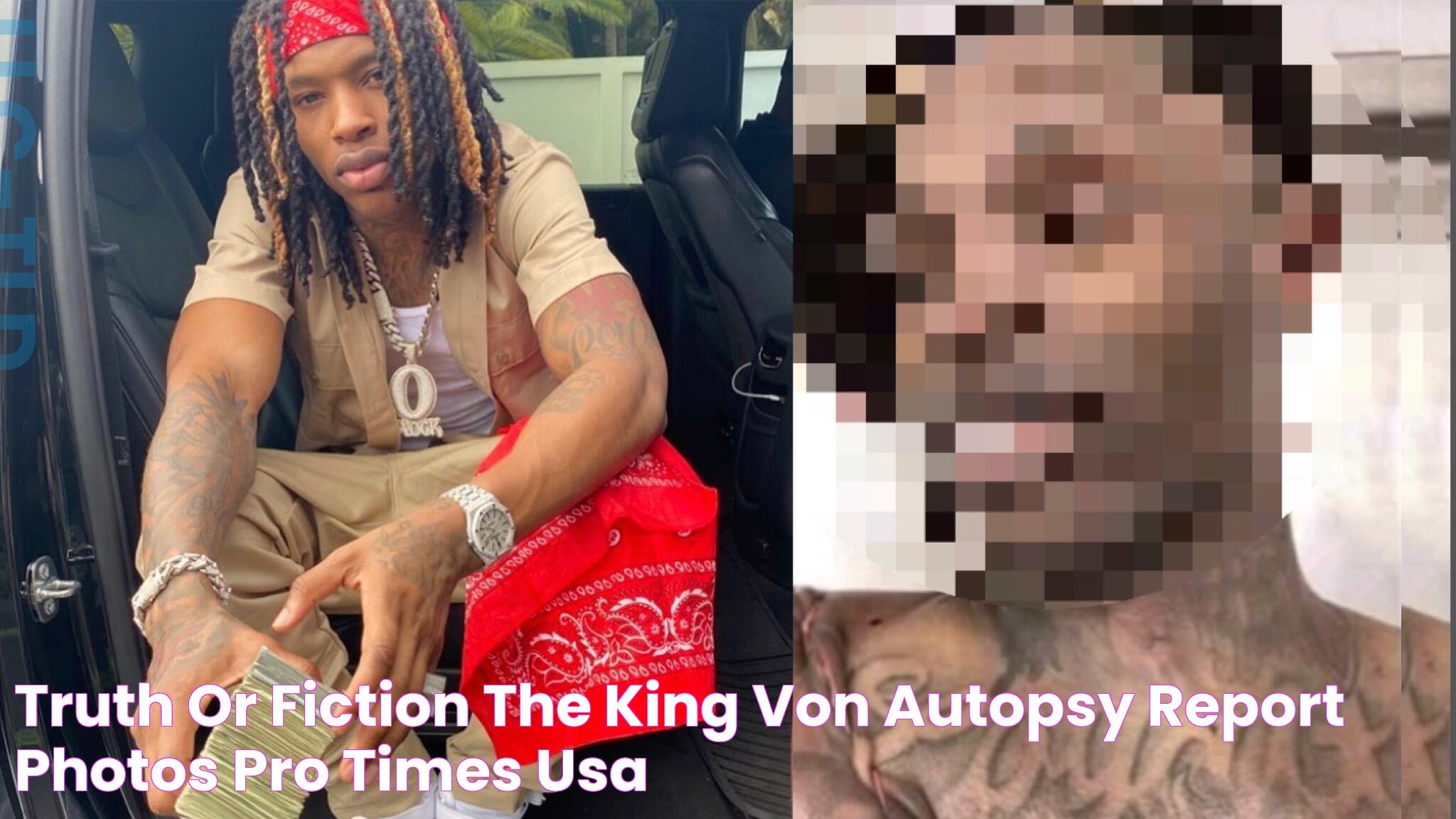 King Von Autopsy Reveals Cause Of Death