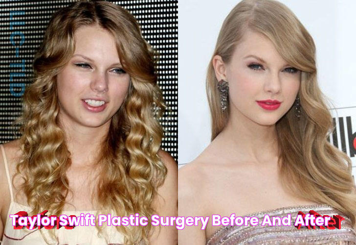 Taylor Swift Plastic Surgery Before and After