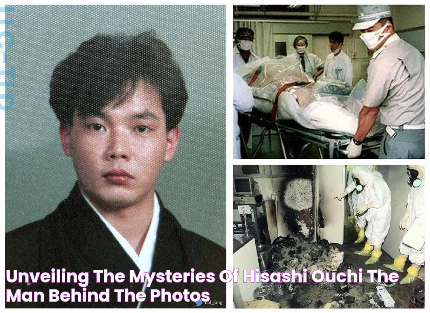 Hisashi Ouchi Photos - A Haunting Look At The Effects Of Radiation