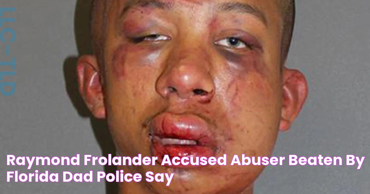 Raymond Frolander, accused abuser, beaten by Florida dad, police say