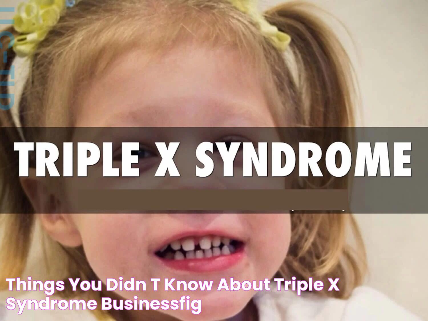 Things you didn't know about Triple X Syndrome Businessfig