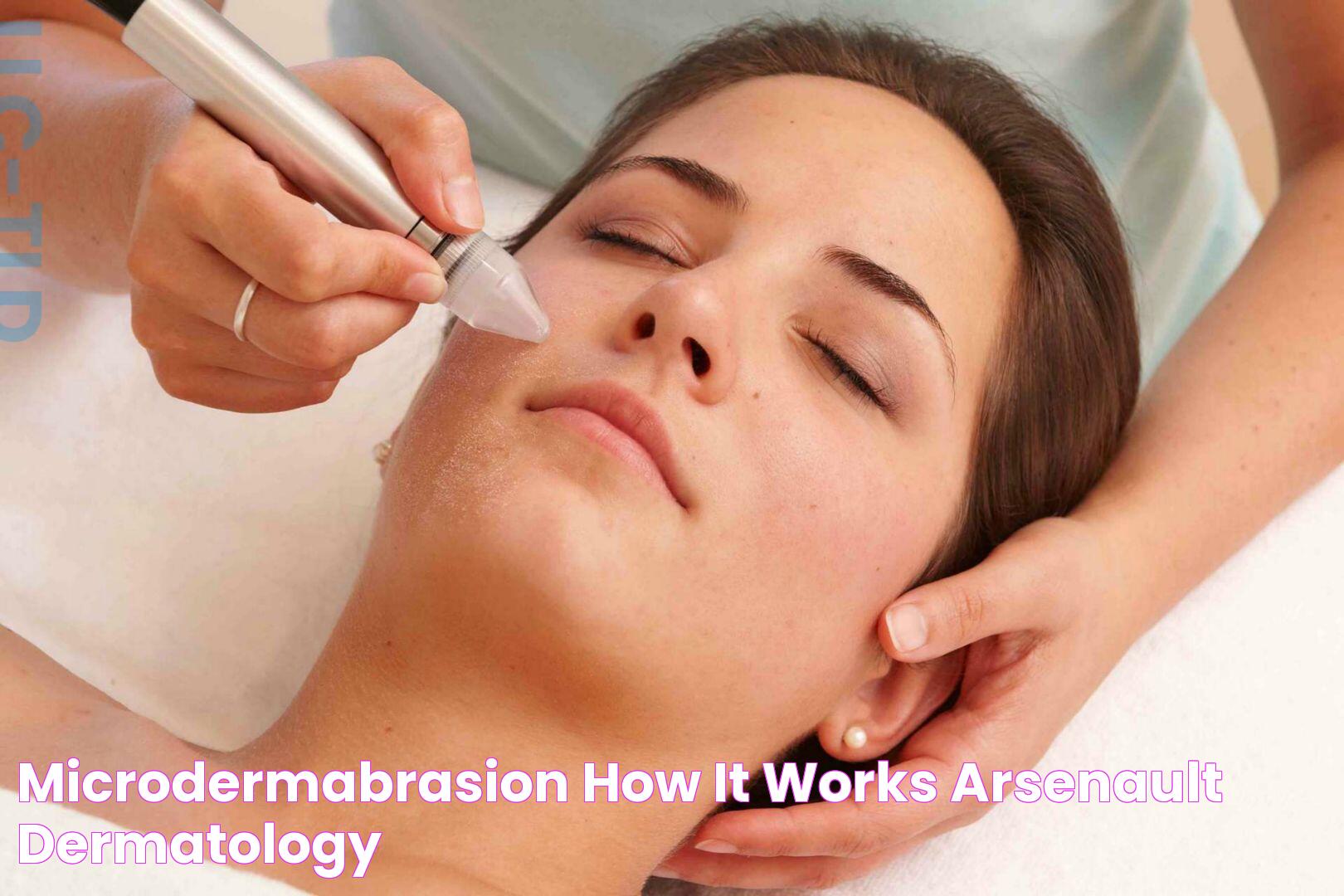 Microdermabrasion How It Works Arsenault Dermatology