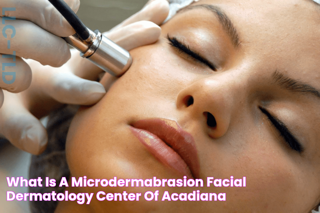 Discover The Power Of Ultimate Face Microdermabrasion: Your Path To Radiant Skin