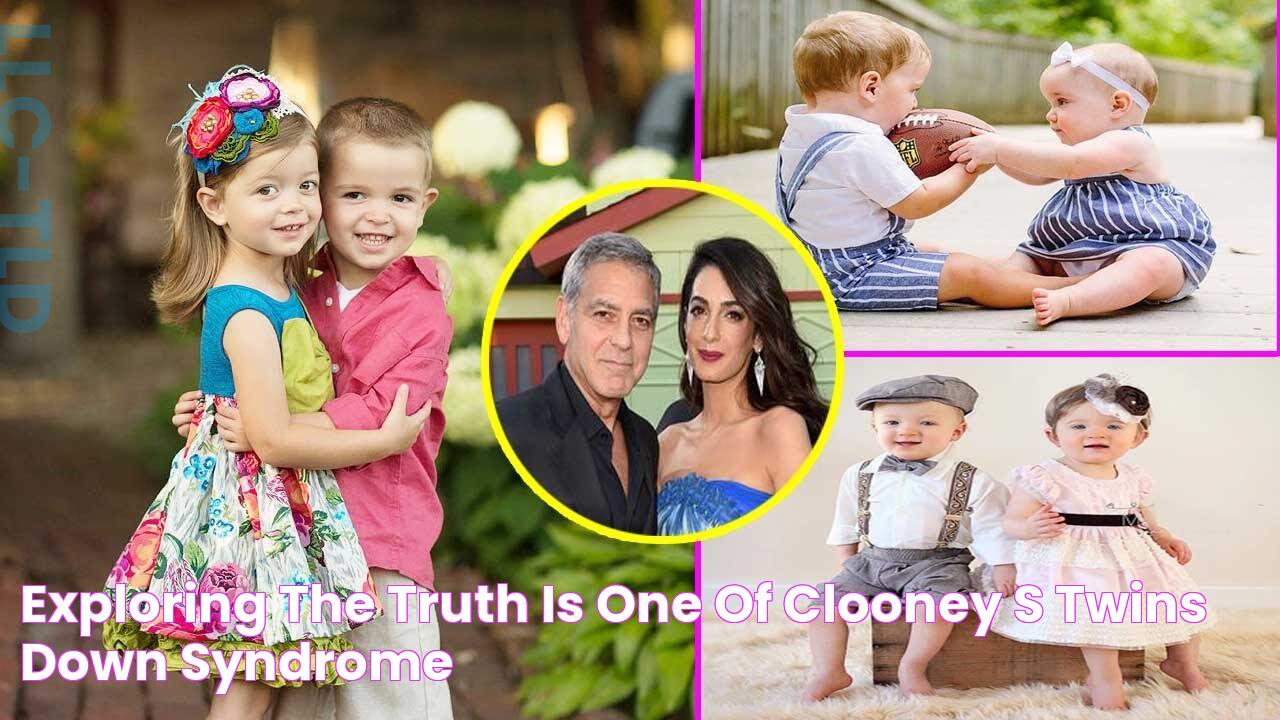 Exploring The Truth Is One Of Clooney's Twins Down Syndrome?