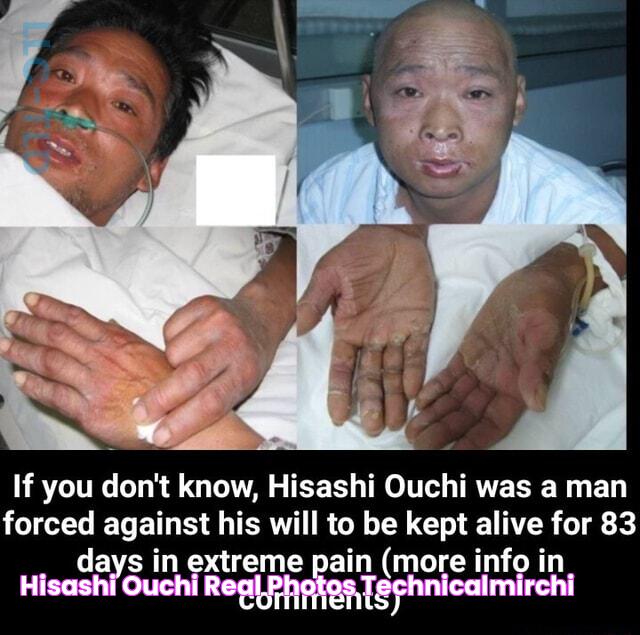 Hisashi Ouchi Real Photos » Technicalmirchi