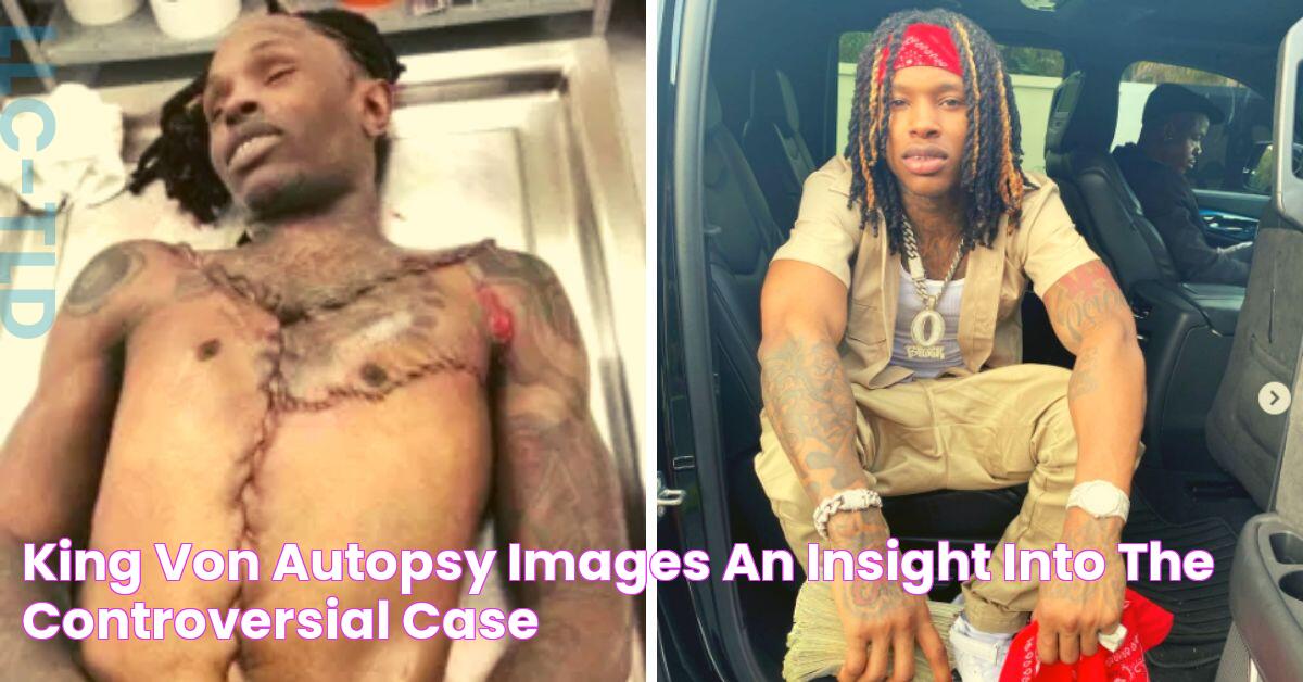 Shocking: Leaked King Von Autopsy Photo Surfaces