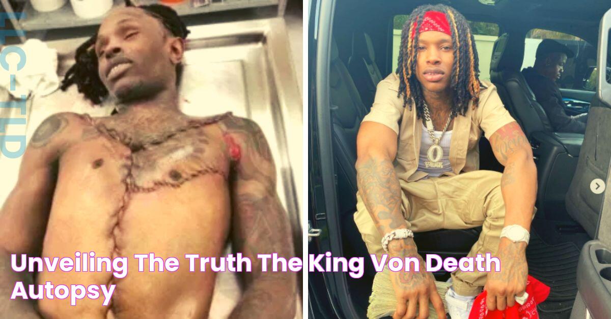 Unveiling The Truth The King Von Death Autopsy