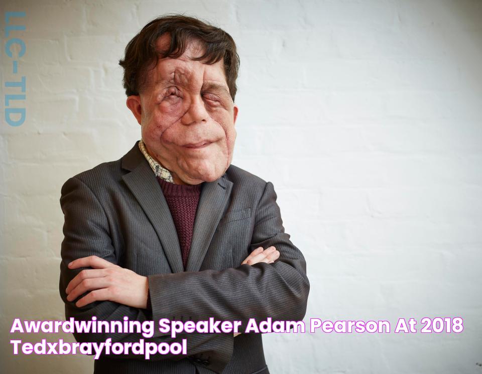 Awardwinning speaker Adam Pearson at 2018 TEDxBrayfordPool