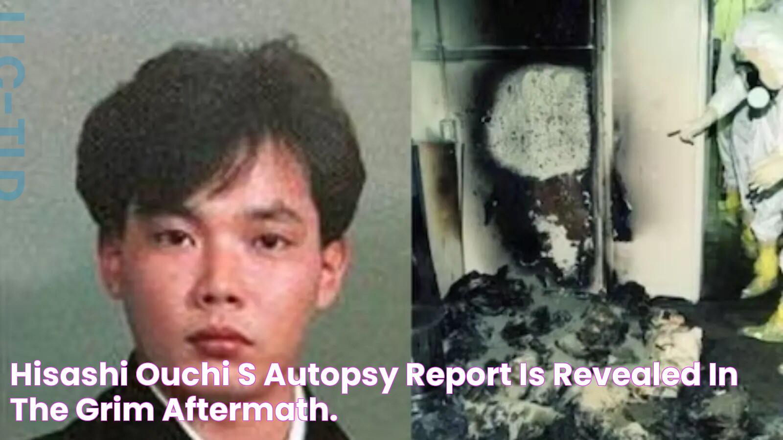 Hisashi Ouchi's Autopsy Report Is Revealed In The Grim Aftermath.