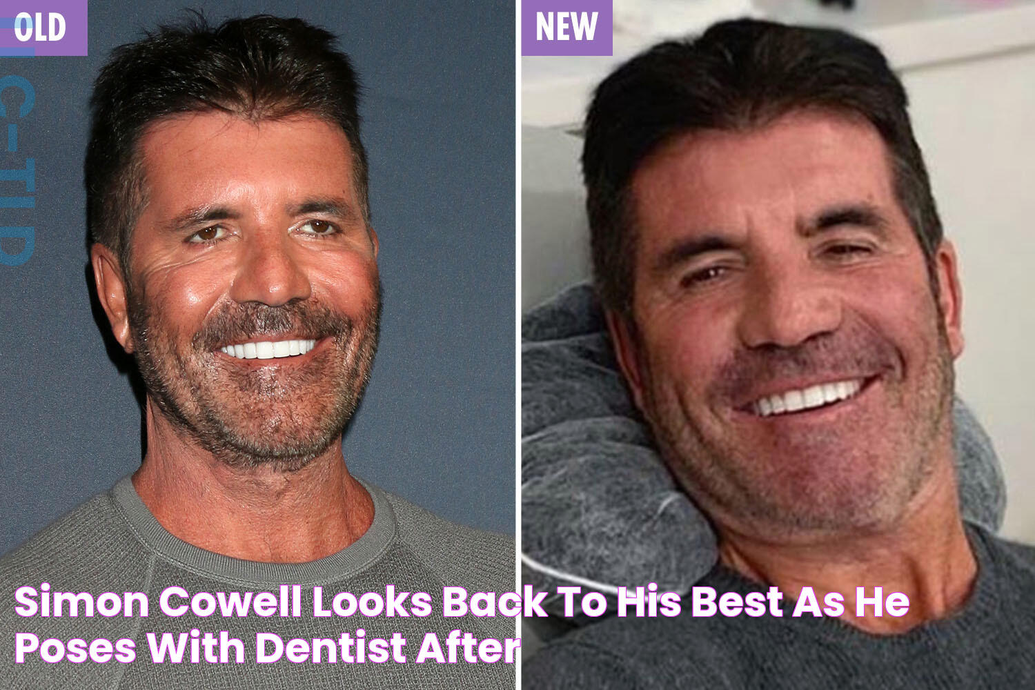 Simon Cowell looks back to his best as he poses with dentist after