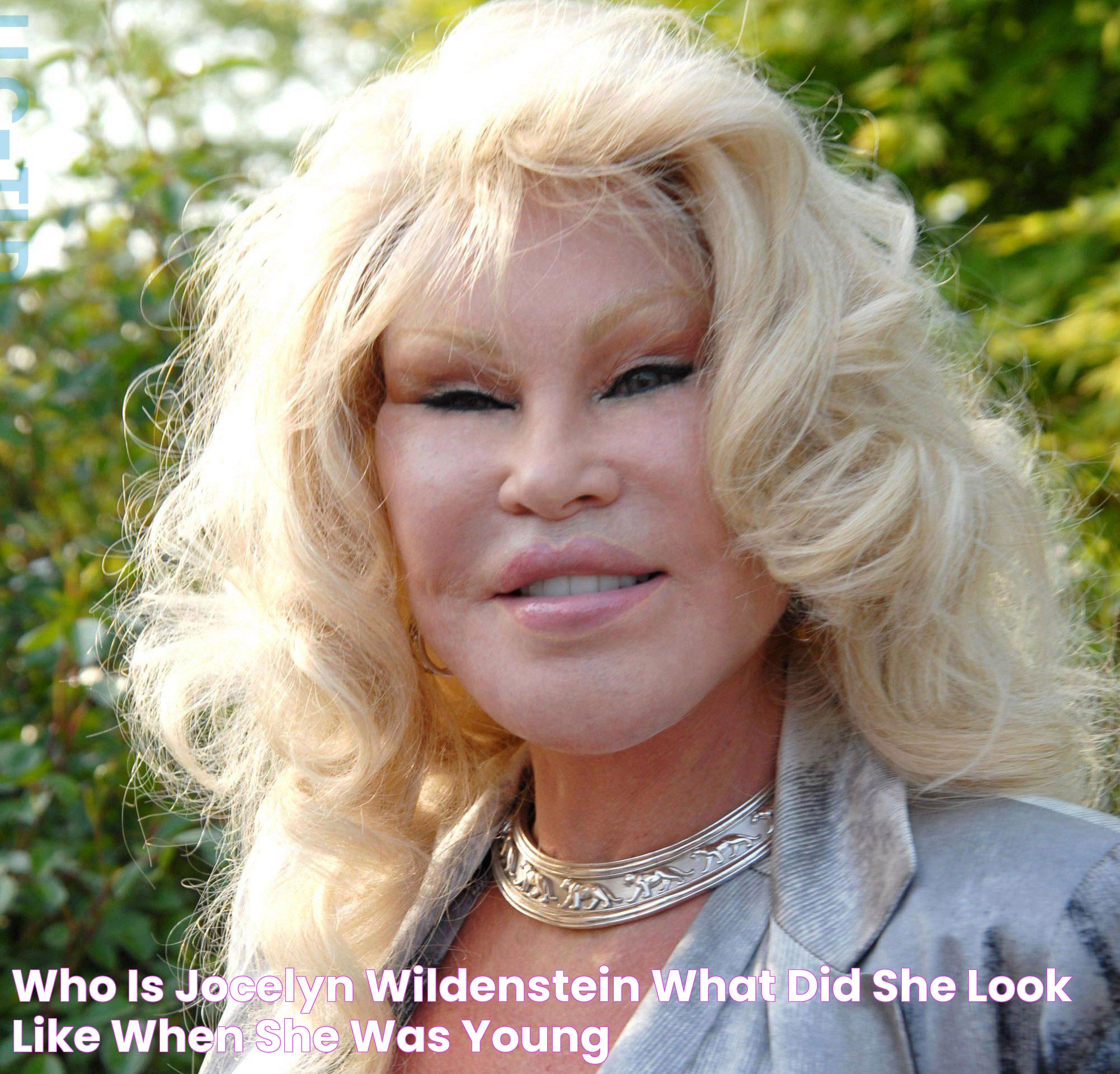 Who is Jocelyn Wildenstein, what did she look like when she was young