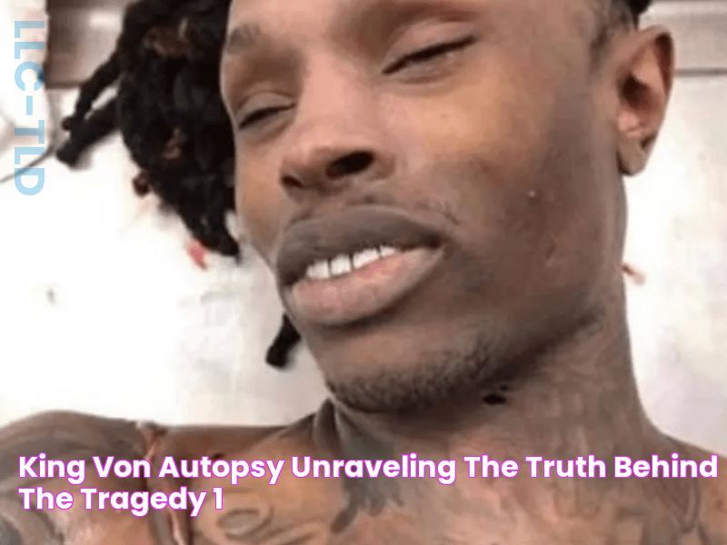 King Von Autopsy Unraveling the Truth Behind the Tragedy