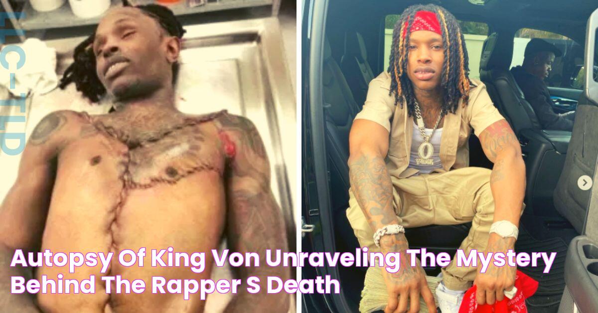 Autopsy Of King Von Unraveling The Mystery Behind The Rapper's Death