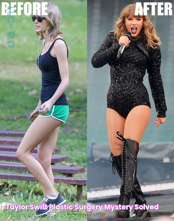 Taylor Swift Plastic Surgery Mystery SOLVED!