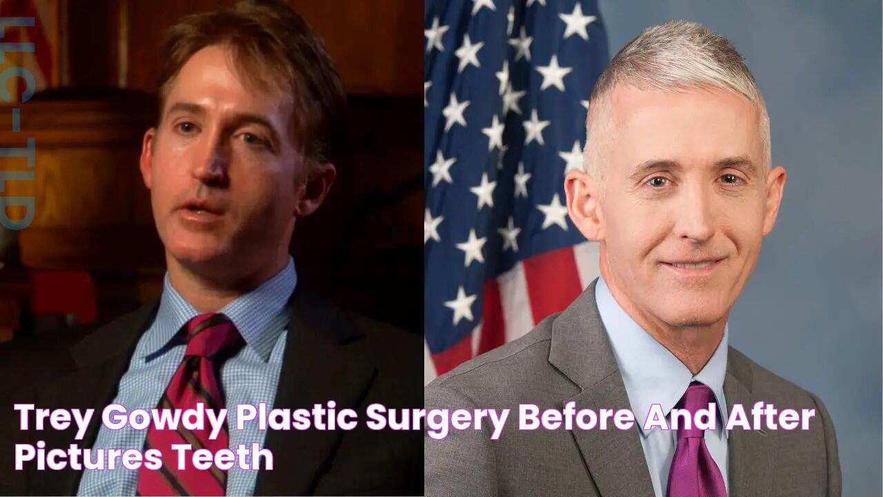 Unmasking The Truth: Trey Gowdy's Plastic Surgery Journey