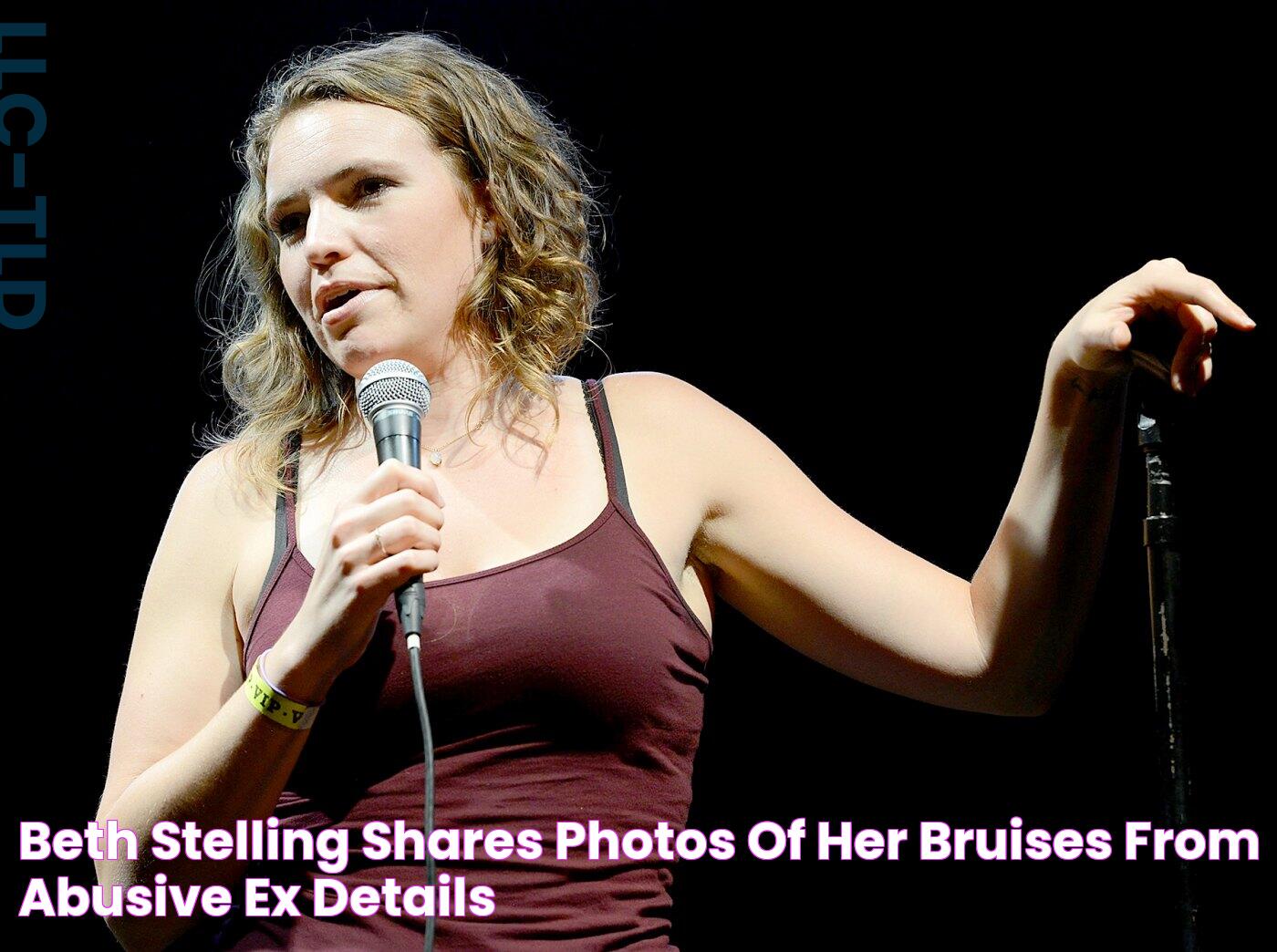 Beth Stelling Shares Photos of Her Bruises From Abusive Ex Details