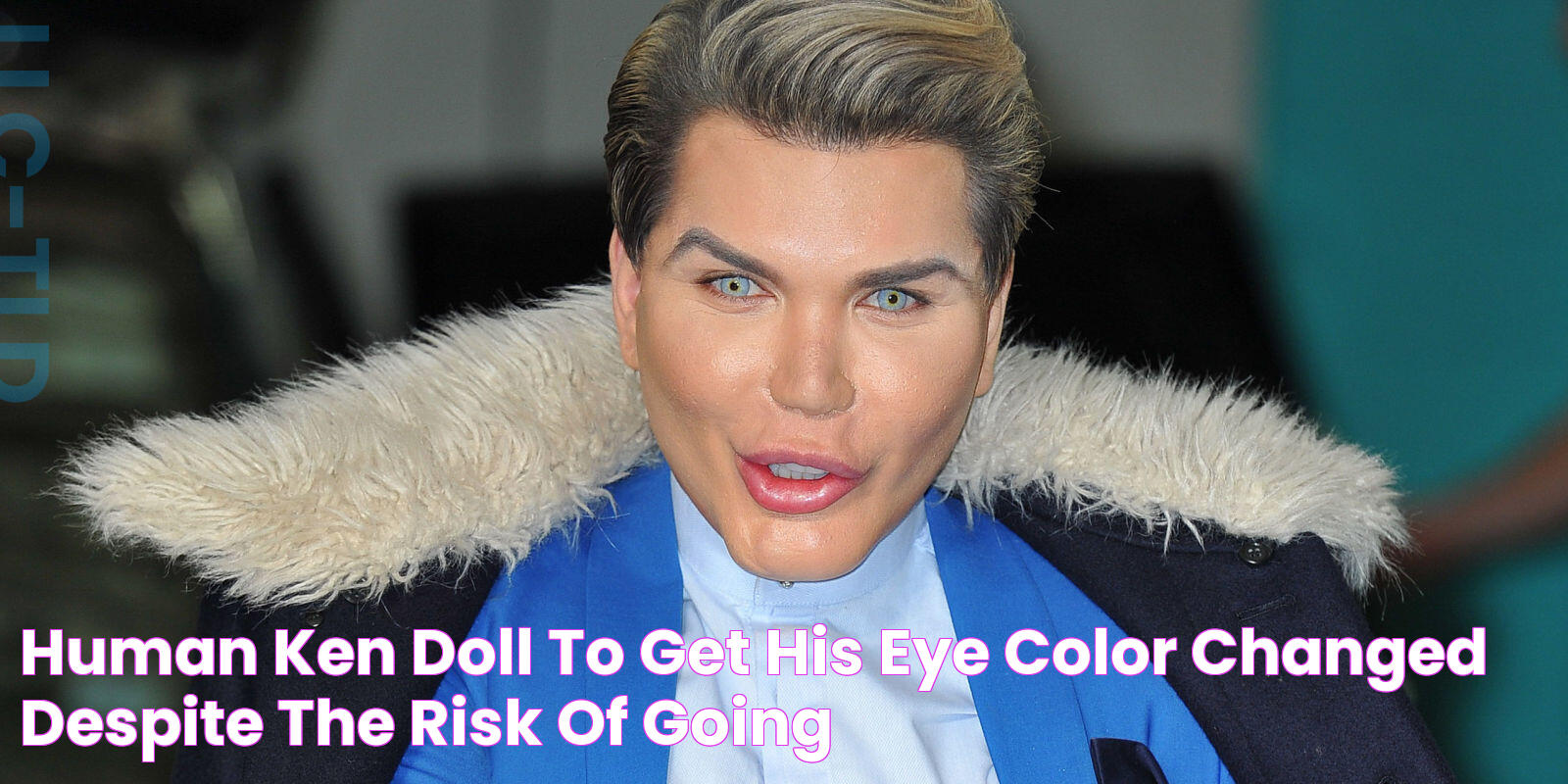 Human 'Ken Doll' To Get His Eye Color Changed Despite The Risk Of Going