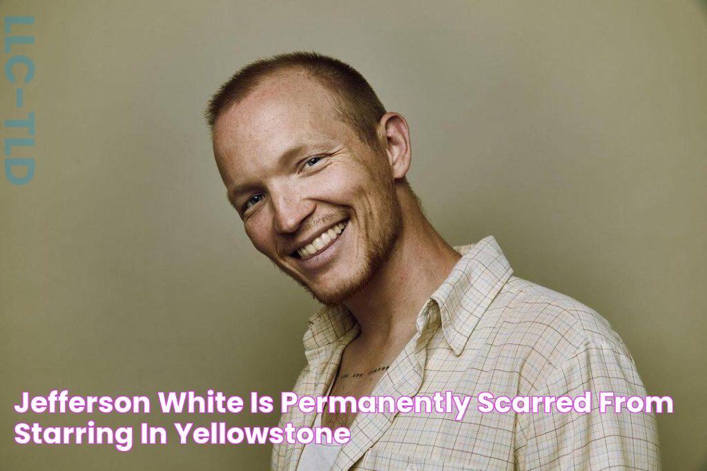 Jefferson White Is Permanently Scarred From Starring In Yellowstone