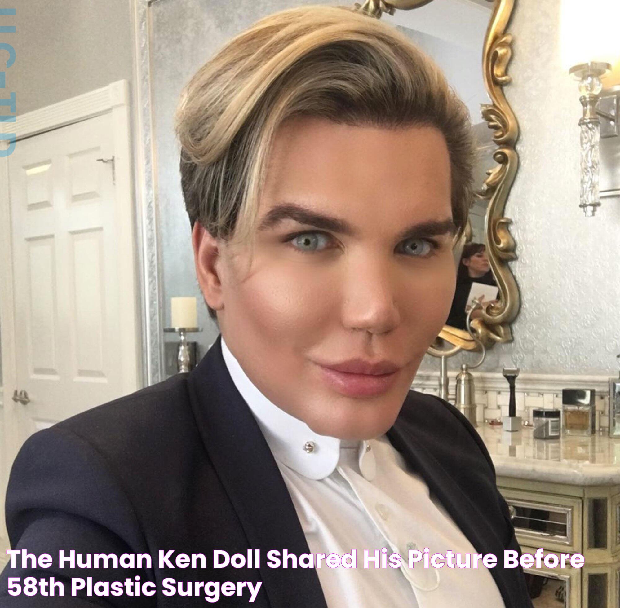 The Human Ken Doll: A Living, Breathing Miracle Of Modern Cosmetic Surgery