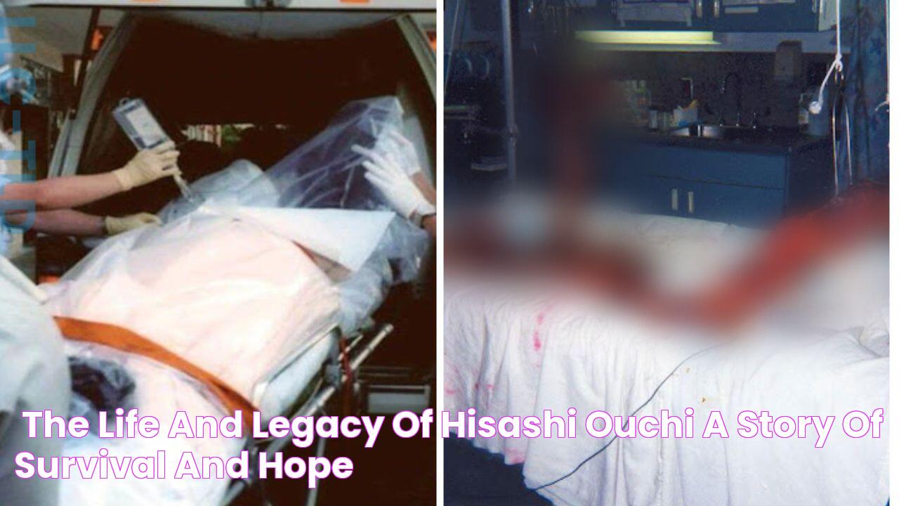 **The Life And Legacy Of Hisashi Ouchi A Story Of Survival And Hope**