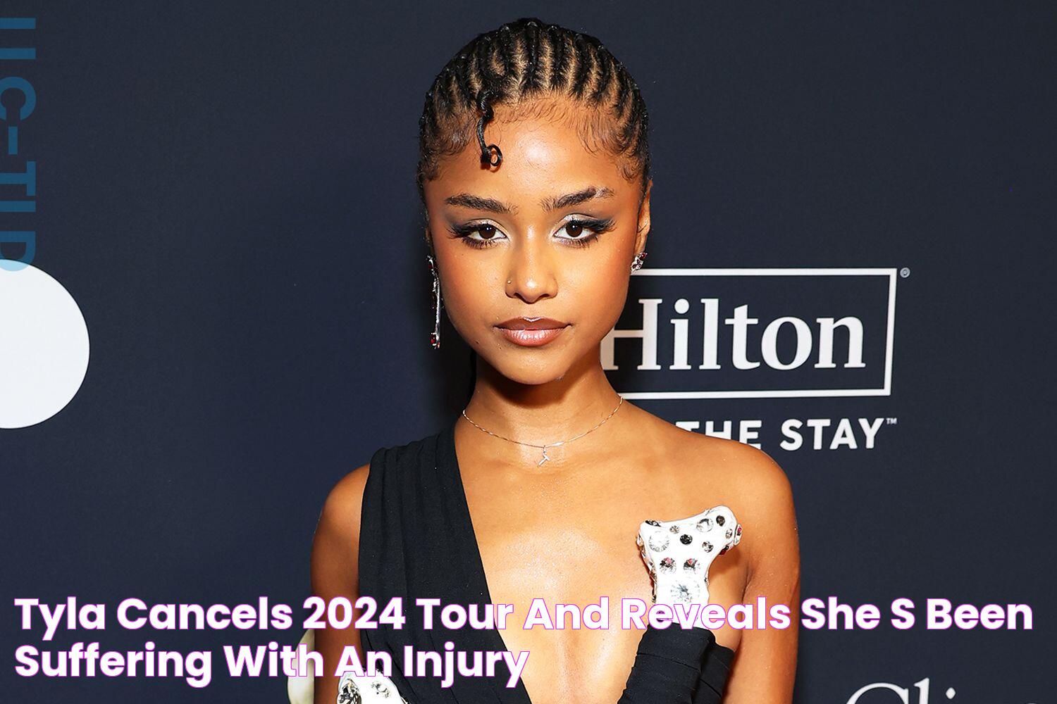 Tyla Cancels 2024 Tour and Reveals She's Been 'Suffering with an Injury'