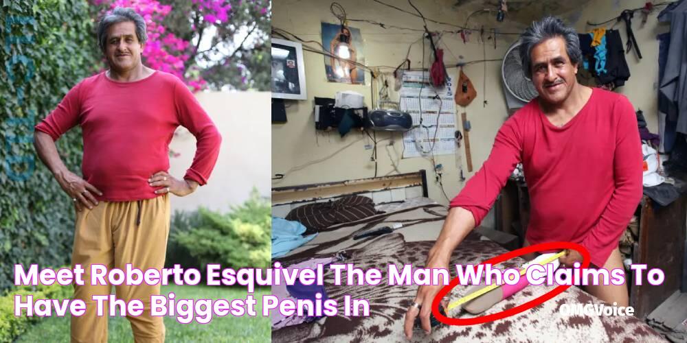 Meet Roberto Esquivel, The Man Who Claims To Have The Biggest Penis In