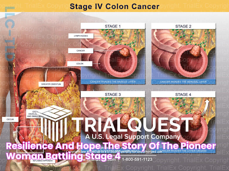 Unveiling The Truth: Ree Drummond's Colon Cancer Journey