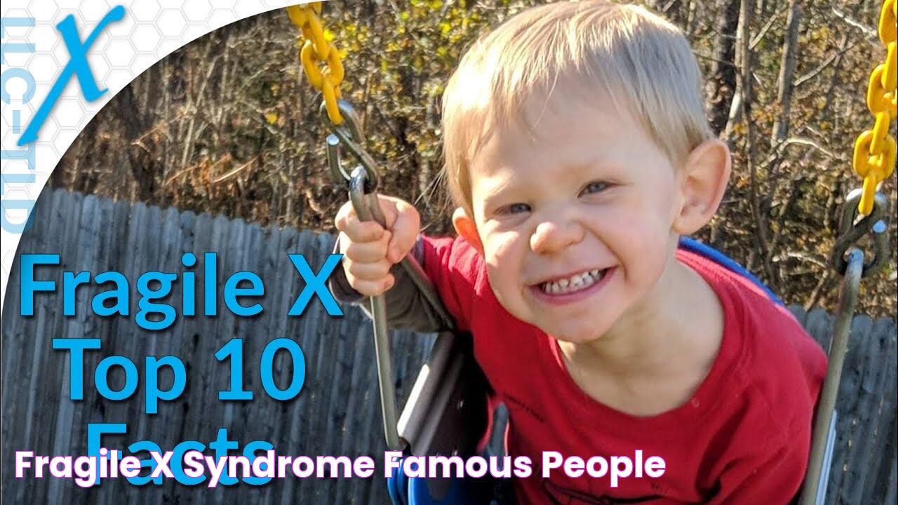 Fragile X Syndrome Famous People