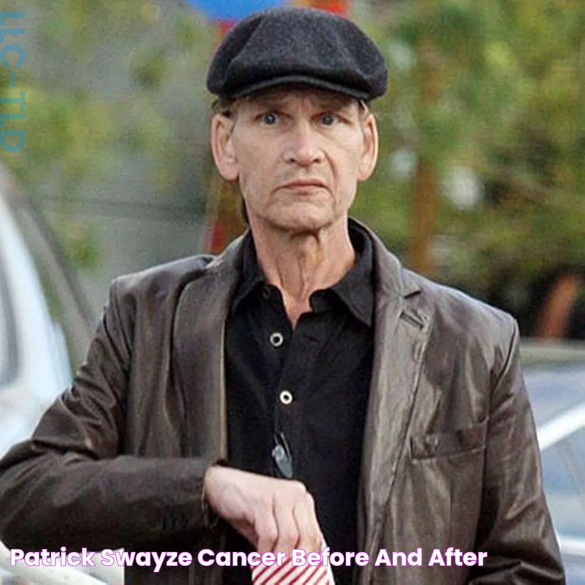 Patrick Swayze Cancer Before And After