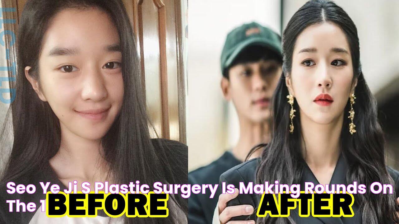 Seo Ye-ji's Plastic Surgery Transformation: A Detailed Analysis