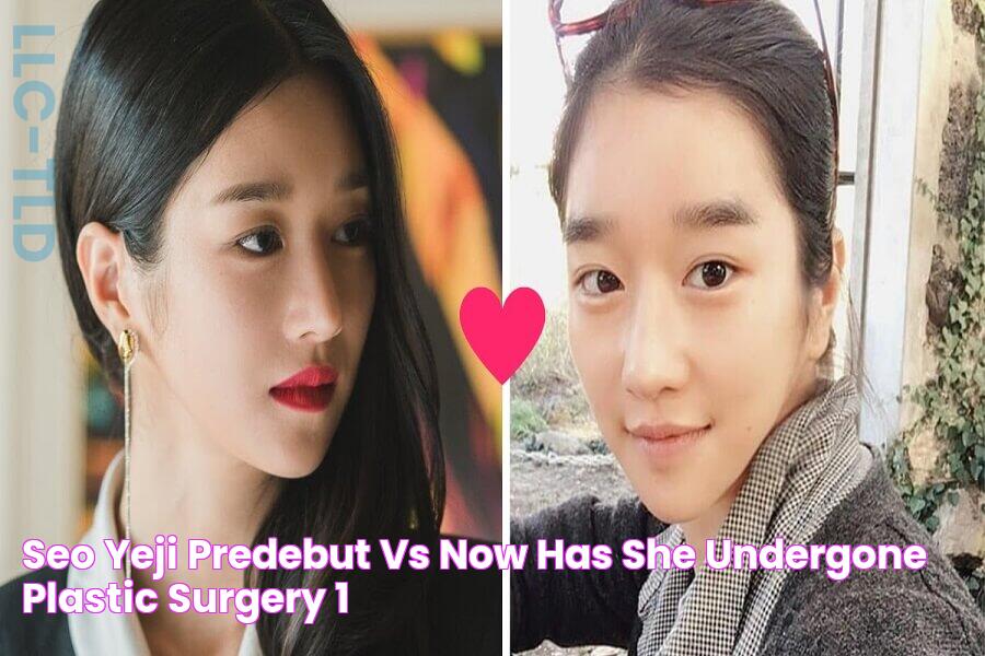 Seo Yeji PreDebut vs Now Has She Undergone Plastic Surgery?