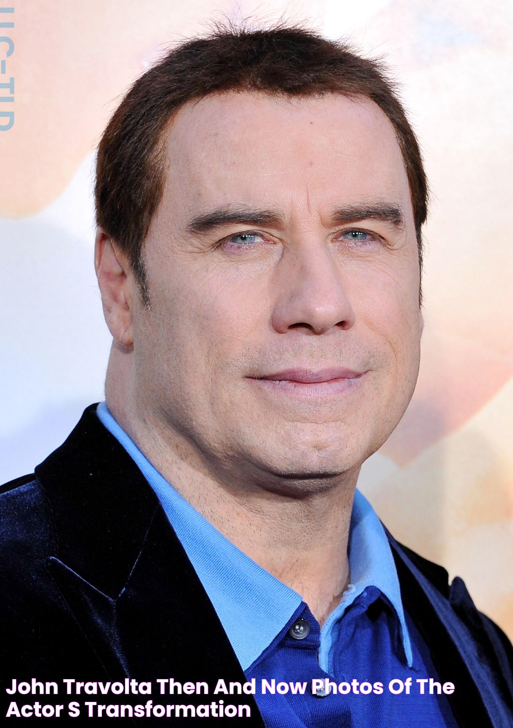 John Travolta's Parkinson's Journey: Symptoms, Diagnosis, And Legacy