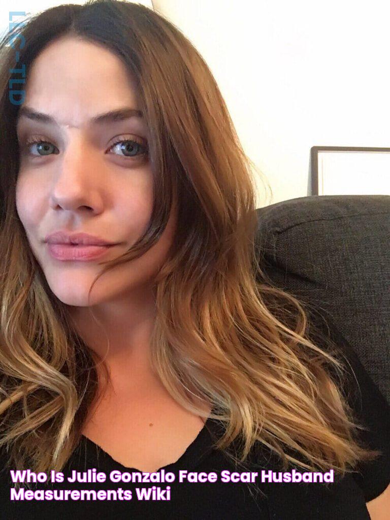 Who is Julie Gonzalo? Face scar, husband, measurements, Wiki