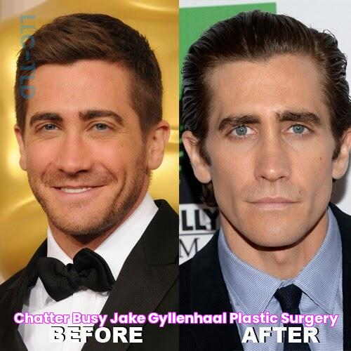 Jake Gyllenhaal's Plastic Surgery: Before And After Transformation