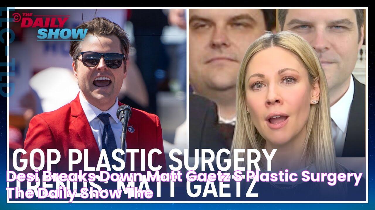 Desi Breaks Down Matt Gaetz’s Plastic Surgery The Daily Show The