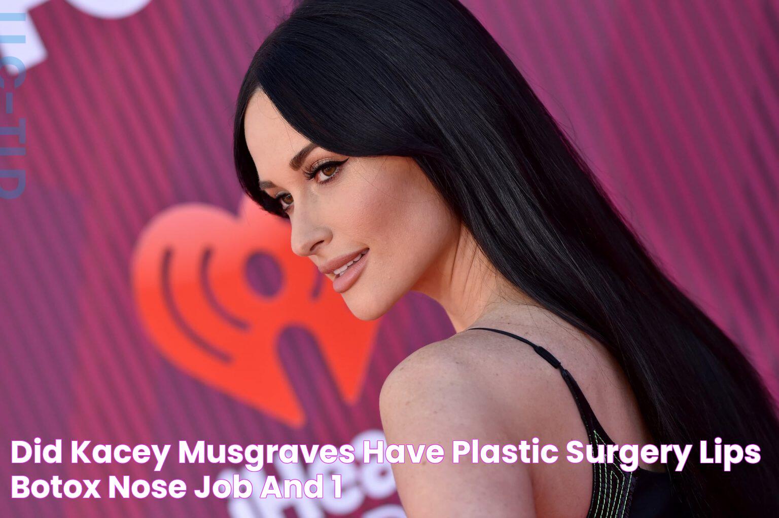 Did Kacey Musgraves have Plastic Surgery? Lips, Botox, Nose Job, and