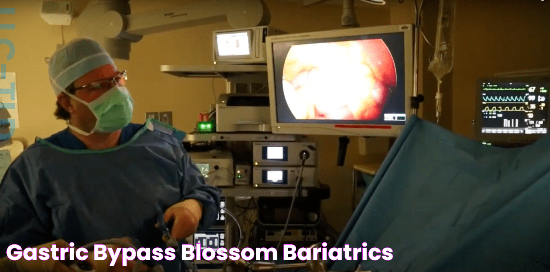 Gastric Bypass Blossom Bariatrics