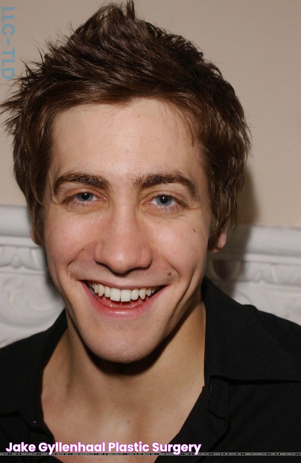 Jake Gyllenhaal Plastic Surgery