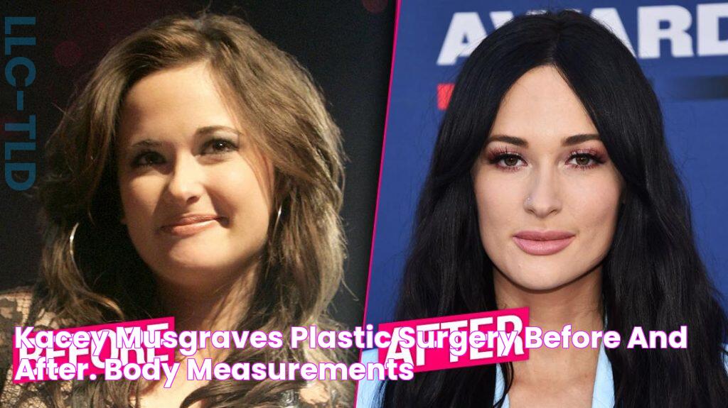 Kacey Musgraves Nose Job Procedure: Before And After Details