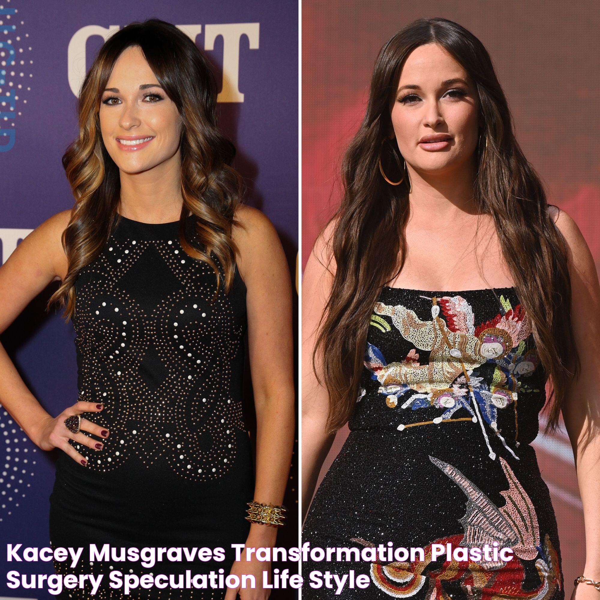 Kacey Musgraves Transformation, Plastic Surgery Speculation Life & Style