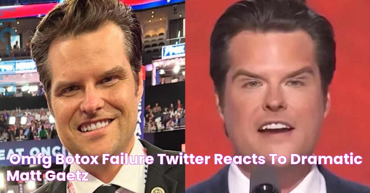 "OMFG! Botox Failure!"— Twitter Reacts to Dramatic Matt Gaetz