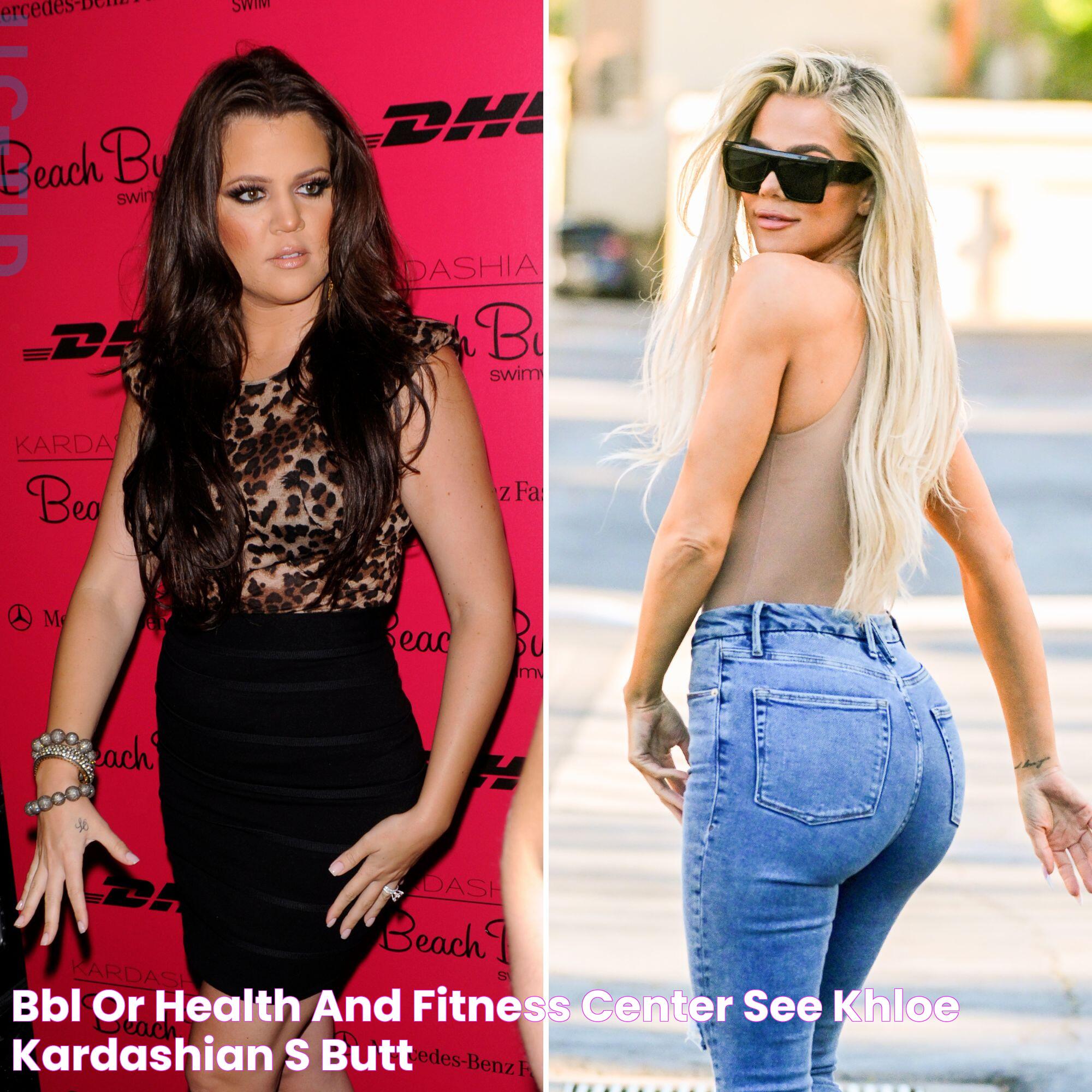 Uncovering Khloe Kardashian's BBL Journey: From Denial To Transparency