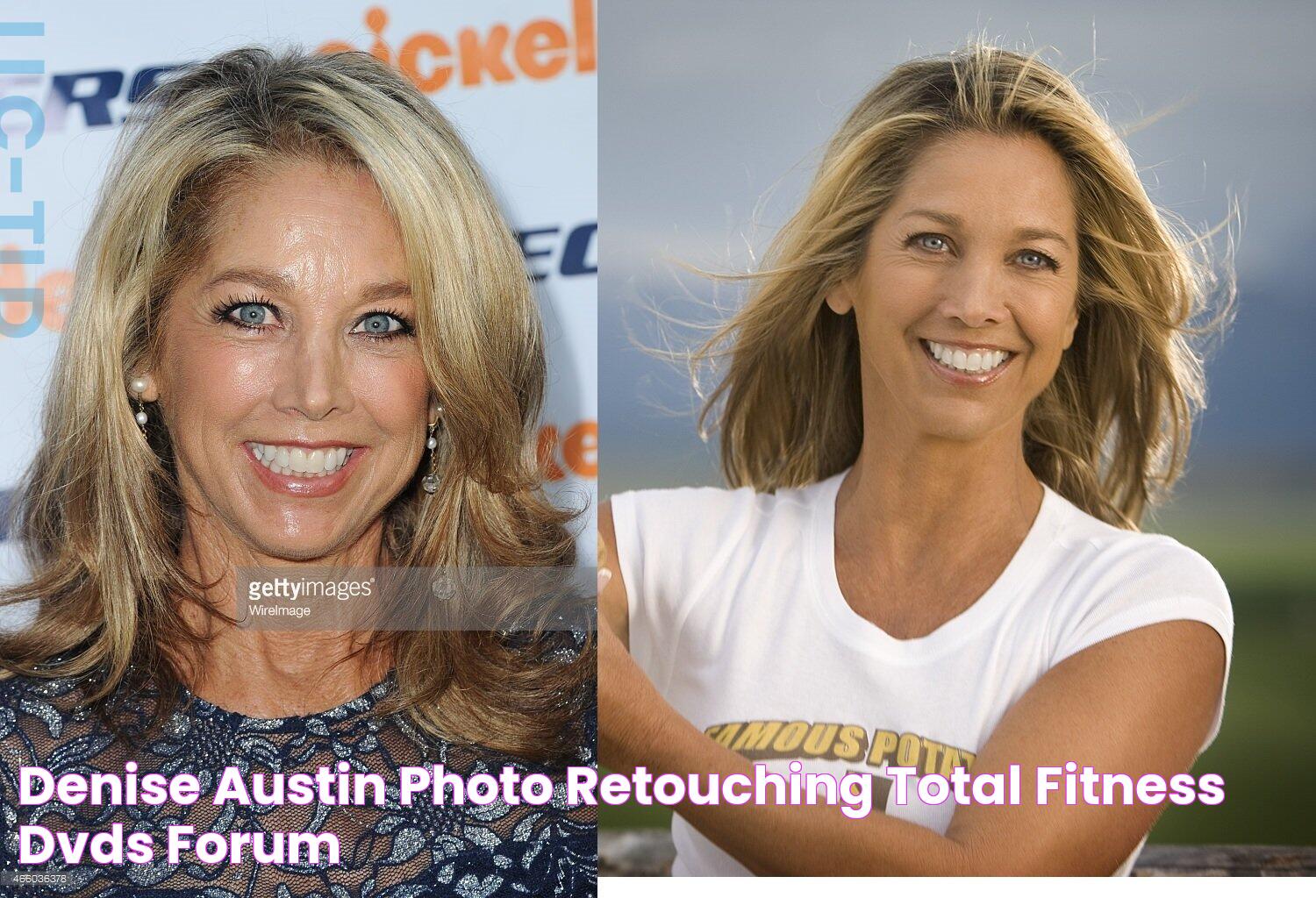 Unveiling The Truth: Denise Austin's Plastic Surgery Journey